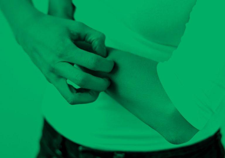 person itching elbow